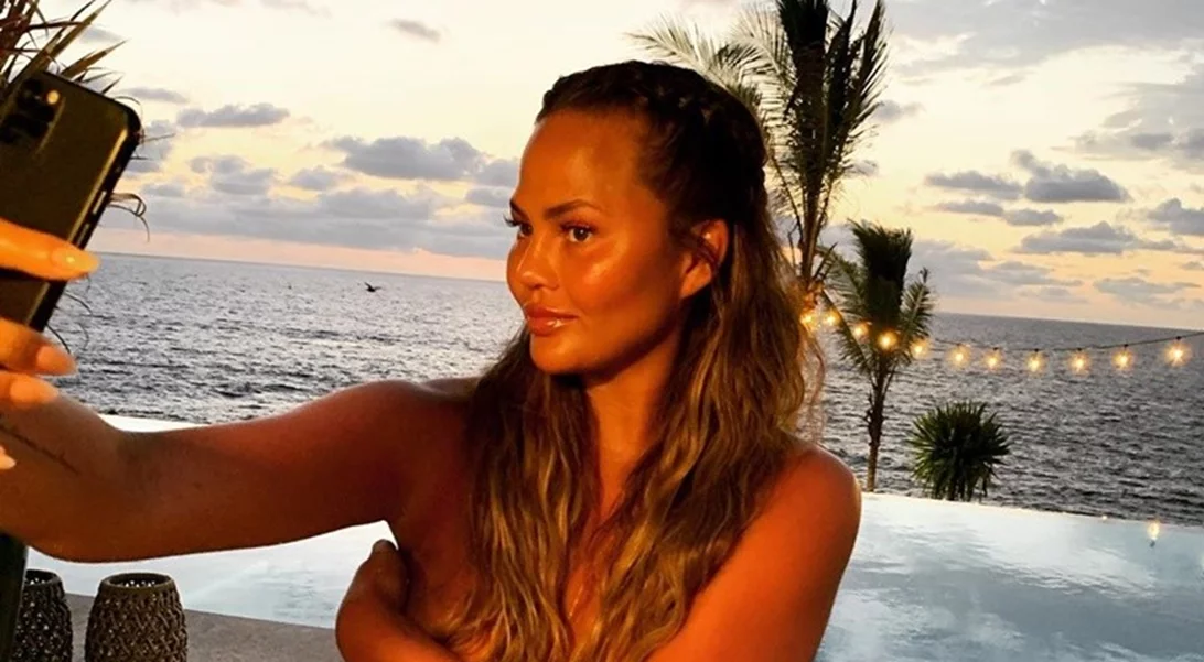 Chrissy Teigen | Δείχνει τις ουλές στο στήθος της για όσους δεν πιστεύουν ότι έκανε αφαίρεση