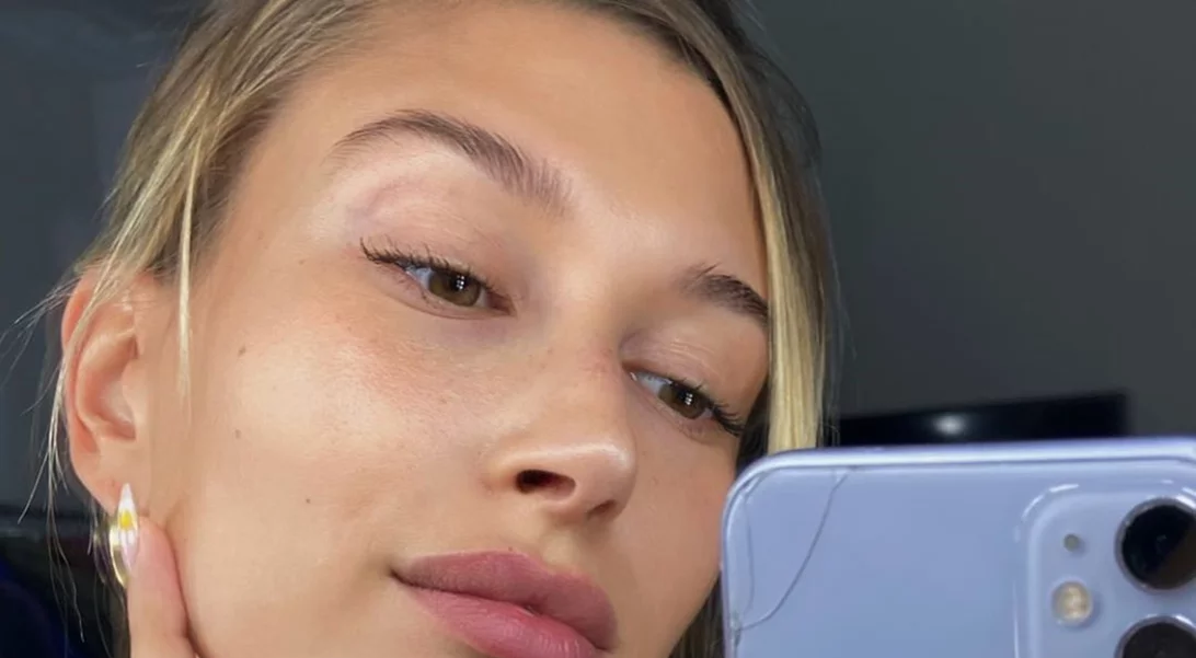 H Hailey Bieber αποκάλυψε πώς έχει καταφέρει να αποφύγει την ακμή που προκαλεί η προστατευτική μάσκα
