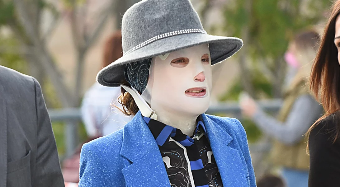 Επίθεση με βιτριόλι | Έφτασε η ώρα της απόφασης - Στο δικαστήριο η Ιωάννα και η κατηγορούμενη