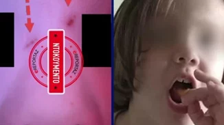 Πάτρα | Τα σημάδια στο πρόσωπο της Μαλένας δείχνουν δολοφονία - Προθανάτιες οι νυχιές στα μάγουλα [Βίντεο]