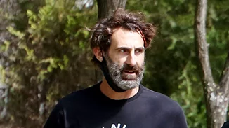 "Έχω υποστεί bullying για την εμφάνισή μου"