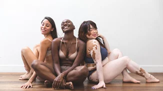 Η κίνηση ματ του Pinterest κατά του body shaming | Φρένο στις διαφημίσεις απώλειας βάρους