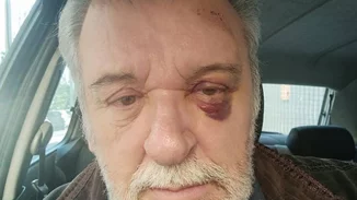 Τάσος Χαλκιάς | Ατύχημα για τον ηθοποιό (εικόνα)