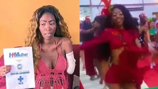 Εφιάλτης για Βραζιλιάνα χορεύτρια | Μπήκε στο νοσοκομείο για αφαίρεση ινομυωμάτων και της ακρωτηρίασαν το χέρι