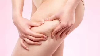 10 τροφές που δημιουργούν κυτταρίτιδα και δεν το ξέρεις!