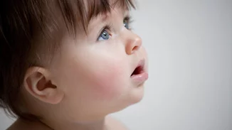 Γιατί το μωρό έχει κόκκινα μάγουλα; Οι πιθανές αιτίες και πότε να ανησυχήσεις