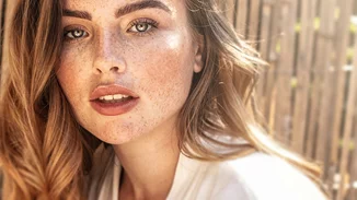 Μπορεί να έχεις αλλεργία στον ήλιο; Μάθε τα συμπτώματα και πώς θα προστατευτείς