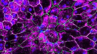 Επαναστατική θεραπεία για την καταπολέμηση της απώλειας όρασης που σχετίζεται με την ηλικία