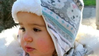 Γιατί το μωρό έχει κόκκινα μάγουλα; Οι πιθανές αιτίες και πότε να ανησυχήσεις