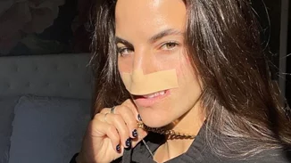 Σκύλος της "έφαγε" το πρόσωπο και αποφάσισε να καταγράψει το ταξίδι της ανάρρωσής της