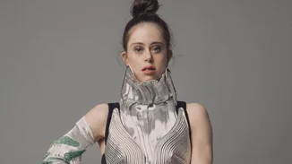 Chelsea Werner | Το κορίτσι "φαινόμενο" με σύνδρομο Down είναι παγκόσμια πρωταθλήτρια και μοντέλο