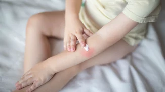 Έγκαυμα στα παιδιά | Τι δεν πρέπει ποτέ να κάνουμε