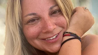 Χωρίς Φίλτρα | 8 Ελληνίδες celebrities που δείχνουν περήφανα τα "ψεγάδια" της επιδερμίδας τους