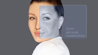 Ποιος φοβάται τις κηλίδες; Όχι εγώ!