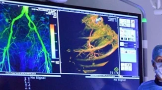 Μέθοδος εντοπισμού της γήρανσης των ανθρώπινων οργάνων προβλέπει τον κίνδυνο ασθενειών