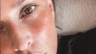 No make up | Η Σίσσυ Χρηστίδου μας δείχνει πώς είναι το πρόσωπό της χωρίς μακιγιάζ