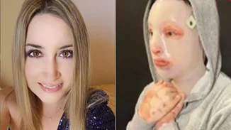 Ιωάννα Παλιοσπύρου | Το σχόλιο της Κατερίνας Καινούργιου κάτω από τη φωτογραφία της από το χειρουργείο