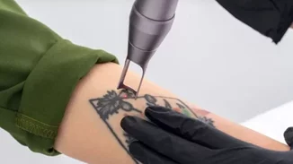 Όλα όσα πρέπει να γνωρίζεις προτού αφαιρέσεις ένα τατουάζ