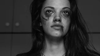 Τζένη Καζάκου | Ποζάρει χτυπημένη και κακοποιημένη - Το δημόσιο μήνυμα