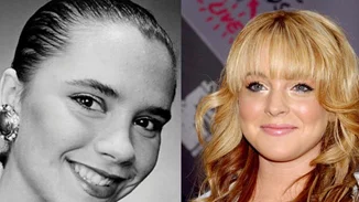 Πριν και μετά τις πλαστικές: Οι επώνυμοι που πλέον τρομάζουμε να αναγνωρίσουμε!