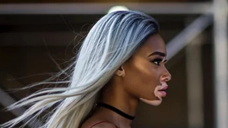 Winnie Harlow: Το μοντέλο που πάσχει από λεύκη γίνεται viral μέσα από μία συγκινητική ανάρτηση