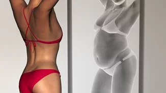 Νευρική ανορεξία και παχυσαρκία: Γιατί ενισχύονται ταυτόχρονα οι διατροφικές διαταραχές στην Ελλάδα;