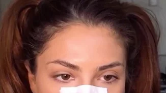 Οι μαύροι πόροι είναι πια παρελθόν με αυτή την μυστική συνταγή