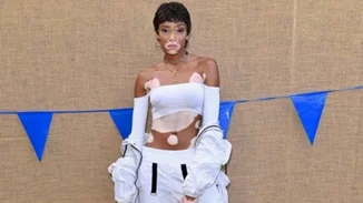 Winnie Harlow, Rain Dove και ακόμη τέσσερα αντισυμβατικά μοντέλα!