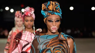 Winnie Harlow: Κι όμως δεν ήθελε να γίνει μοντέλο!