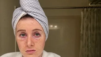 Hanacure: Η μάσκα προσώπου που σε μεταμορφώνει σε γιαγιά πριν σου χαρίσει τέλειο νεανικό δέρμα!