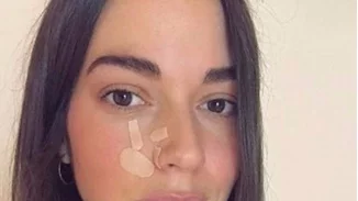 Ισμήνη Νταφοπούλου: Πιο όμορφη από ποτέ μετά τον σοβαρό τραυματισμό στο πρόσωπο!