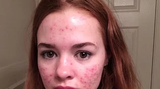 Φωτογράφιζε την ακμή της και έγινε viral!