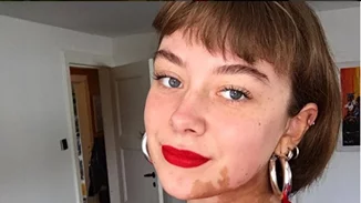 Αυτή η κοπέλα κάλυψε το σημάδι της στο πρόσωπό της με τον πιο τέλειο τρόπο που την έκανε να το αγαπήσει