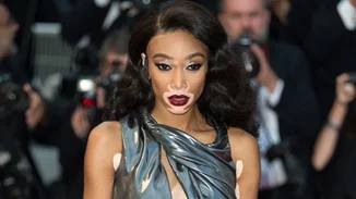 Winnie Harlow | Με εντυπωσιακή ασημένια τουαλέτα στις Κάννες!