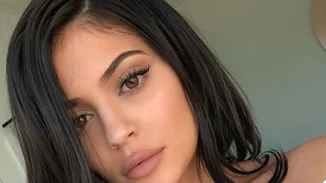 Kylie Jenner | Αυτός είναι ο λόγος που αποφάσισε να αφαιρέσει τα εμφυτεύματα χειλιών