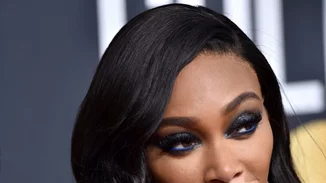 Τέλος τα μακριά μαλλιά για την Winnie Harlow | Δες την με ξανθό à la garçonne