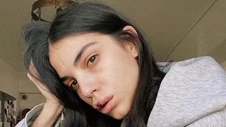 Άννα Μαρία Βέλλη | Το ατύχημα και η φοβερή παραμόρφωση στα χείλη