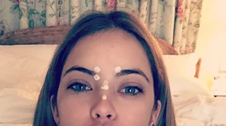 Δεν είσαι μόνη σου! 10 celebrities δείχνουν τα σπυράκια στο πρόσωπό τους