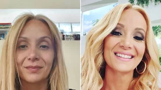 Η Νάταλι Κάκκαβα φωτογραφίζεται χωρίς μακιγιάζ και στέλνει το δικό της μήνυμα στις γυναίκες