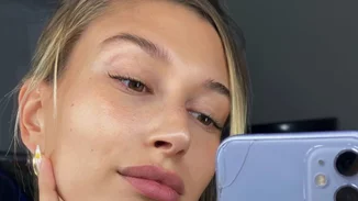 H Hailey Bieber αποκάλυψε πώς έχει καταφέρει να αποφύγει την ακμή που προκαλεί η προστατευτική μάσκα