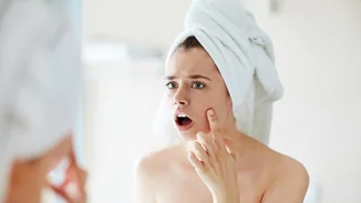 Ακμή; 5 tips για να ξεκινήσεις να την αντιμετωπίζεις από σήμερα κιόλας