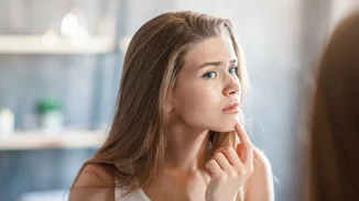 Ακμή στο πηγούνι | Σε τι οφείλεται και πώς μπορείς να την αντιμετωπίσεις