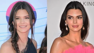 Οι πλαστικές επεμβάσεις των celebrities | Δες το πριν και το μετά