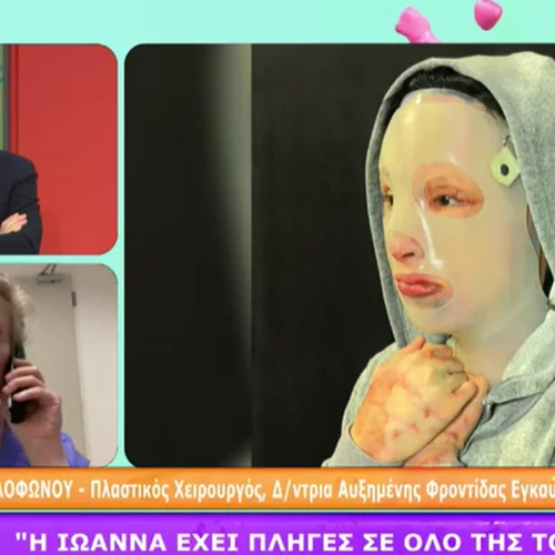 Υπόθεση με βιτριόλι | Συγκλονίζει η γιατρός της 34χρονης Ιωάννας (vid)