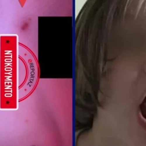 Πάτρα | Τα σημάδια στο πρόσωπο της Μαλένας δείχνουν δολοφονία - Προθανάτιες οι νυχιές στα μάγουλα [Βίντεο]