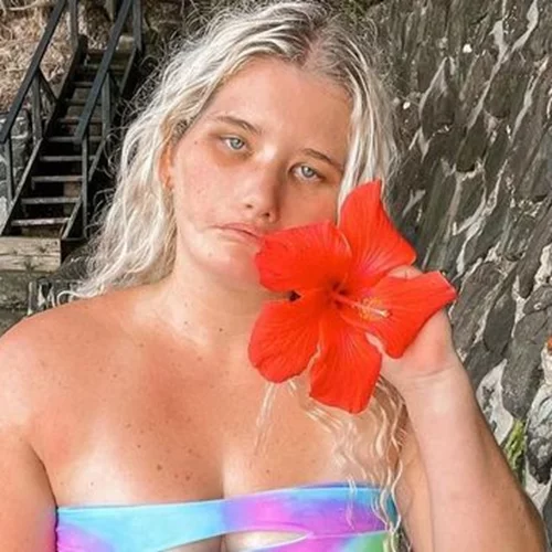 Tayla Clement | Η ιστορία του μοντέλου που δεν μπορεί να χαμογελάσει