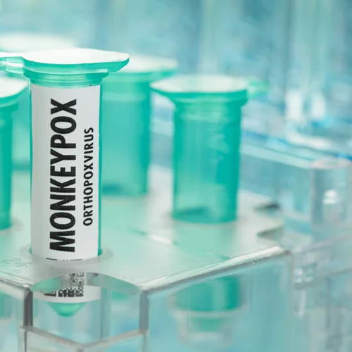 Ο καθηγητής Θάνος Δημόπουλος στο TheTOC για ευλογιά των πιθήκων και οξεία ηπατίτιδα - Τι να προσέξουν οι γονείς