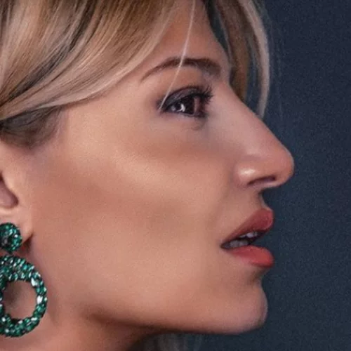 Φαίη Σκορδά | Ποζάρει χωρίς μακιγιάζ και αποδεικνύει ότι είναι εξίσου όμορφη