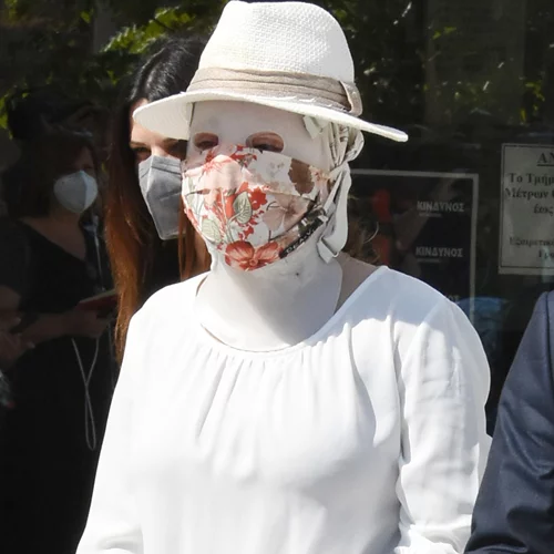 Επίθεση με βιτριόλι | Κύμα συμπαράστασης στην Ιωάννα στο Twitter - "Υποκλινόμαστε στο θάρρος σου κορίτσι μου"