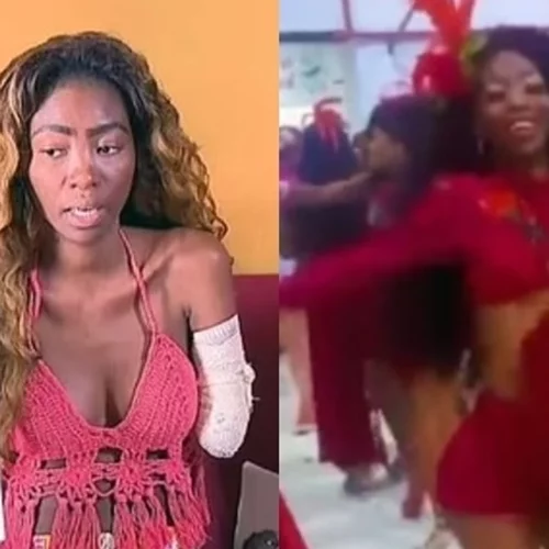 Εφιάλτης για Βραζιλιάνα χορεύτρια | Μπήκε στο νοσοκομείο για αφαίρεση ινομυωμάτων και της ακρωτηρίασαν το χέρι